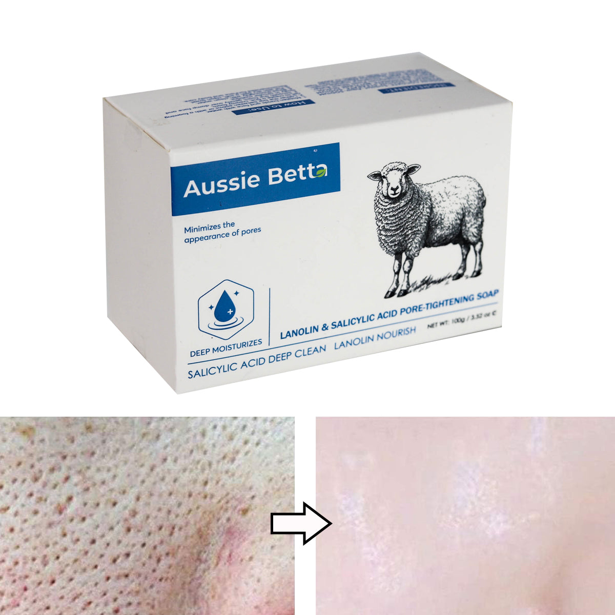 Aussie Betta Lanolin & Salicylic Acid Pore-Tightening Soap