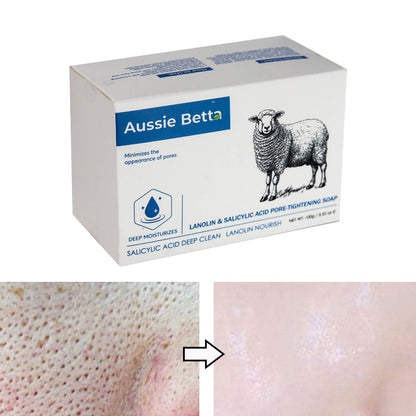 Aussie Betta Lanolin & Salicylic Acid Pore-Tightening Soap