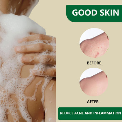 Aussie Betta Gold Turmeric & Lanolin Soap