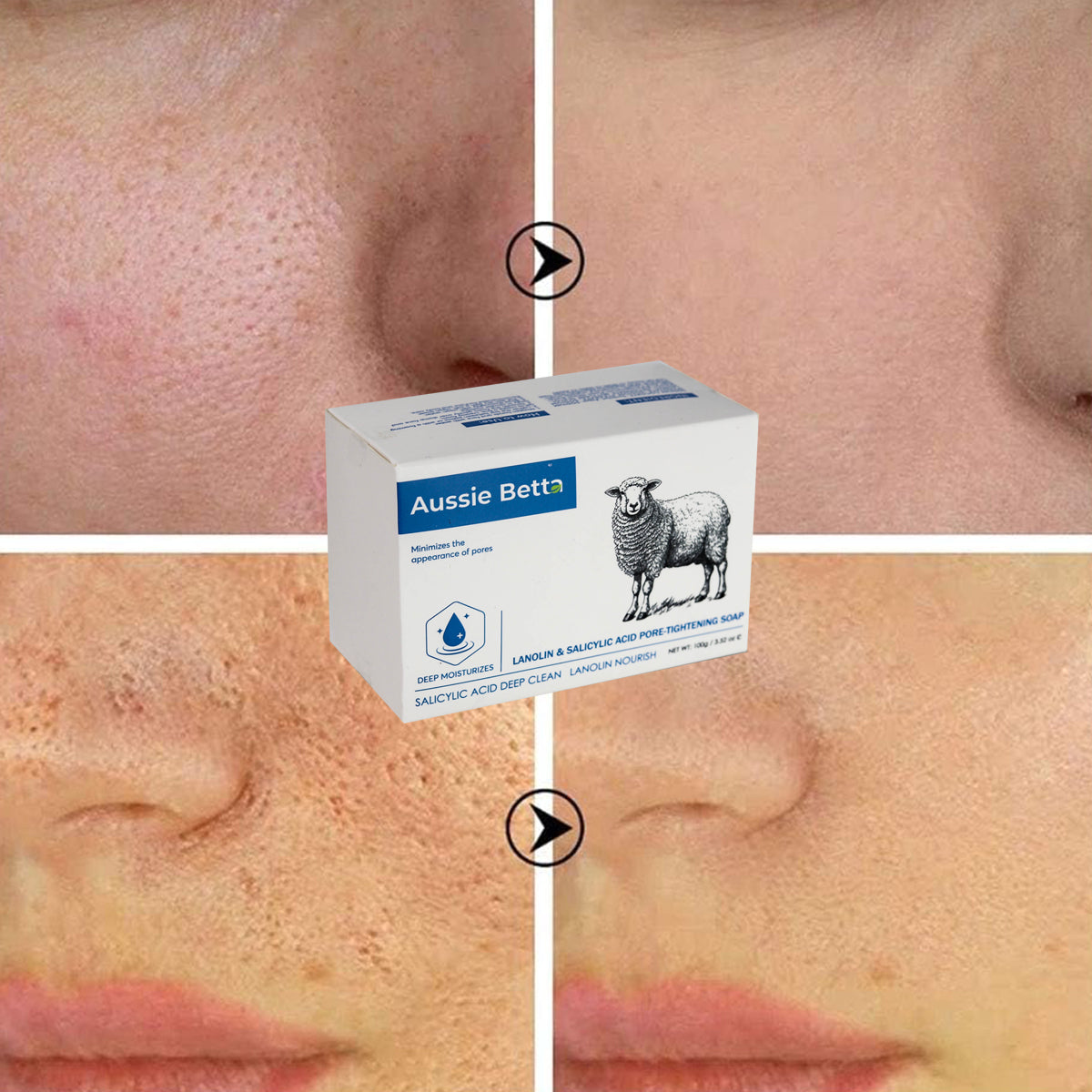 Aussie Betta Lanolin & Salicylic Acid Pore-Tightening Soap