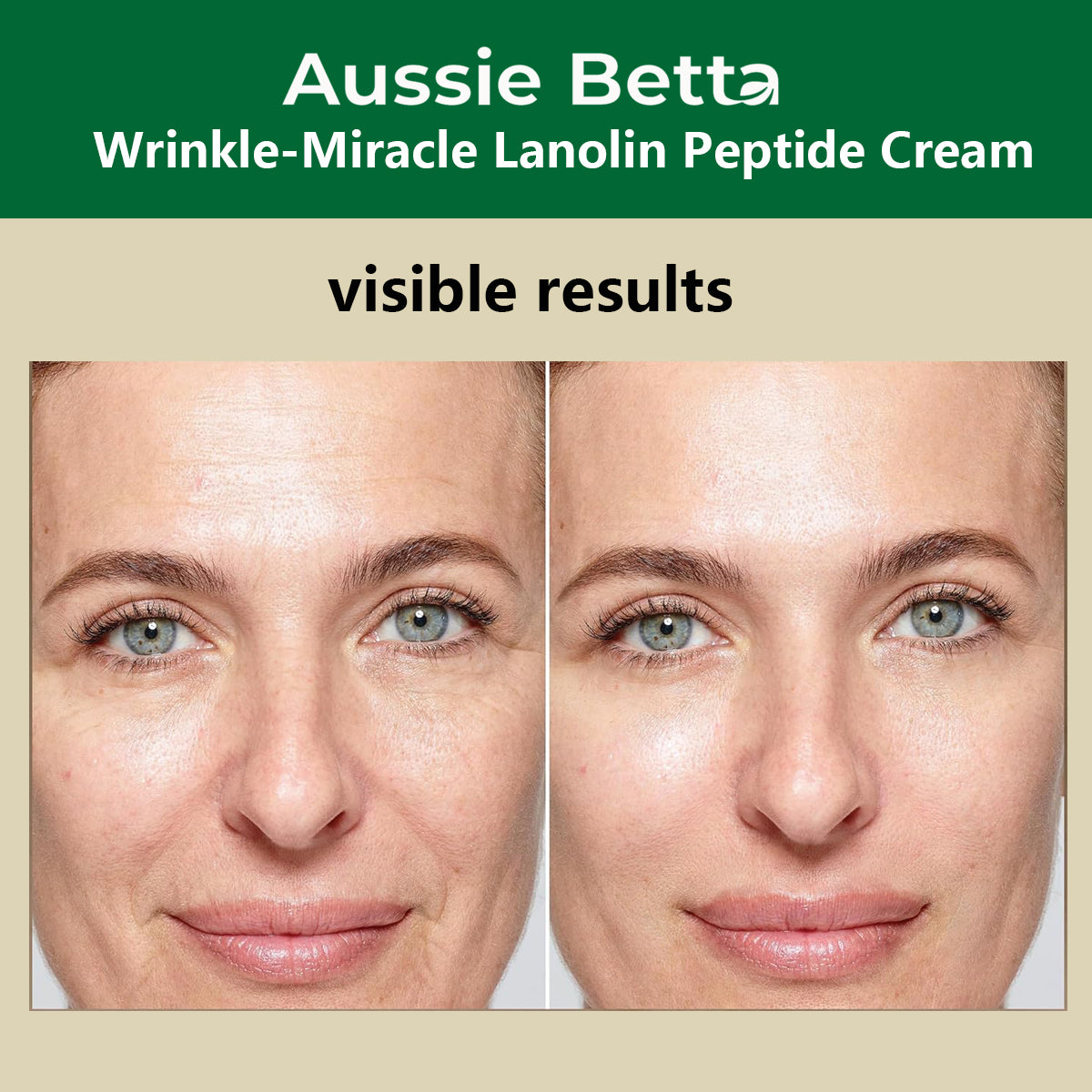 Aussie Betta Miracle Lanolin Peptide Cream