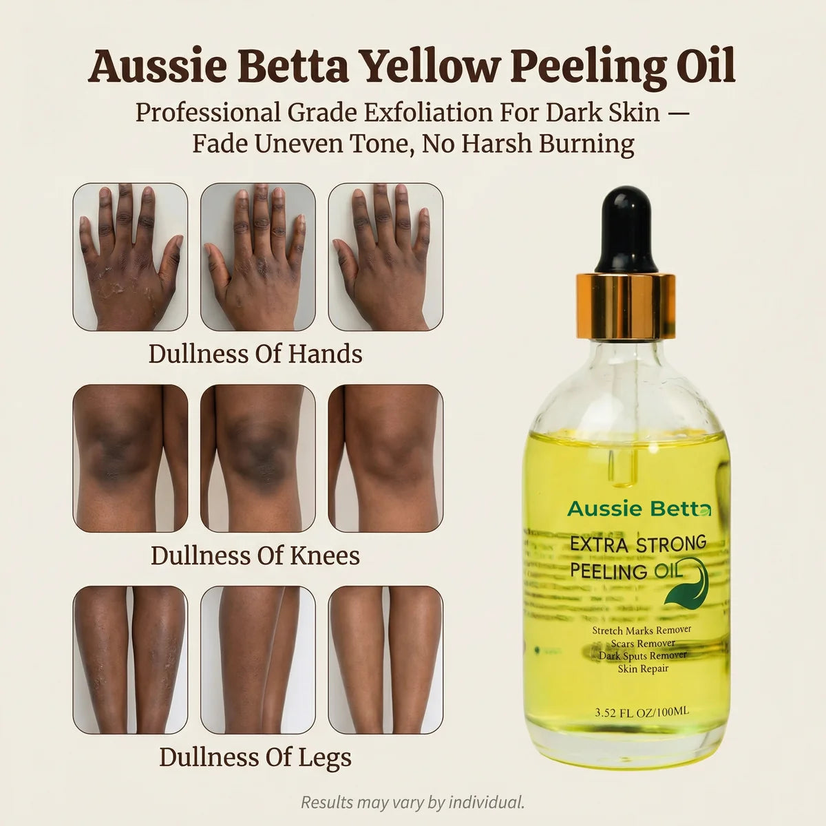 Aussie Betta Yellow Peeling Oil — before photos showing dullness of hands, knees, and legs on dark skin tones, professional grade exfoliation for hyperpigmentation