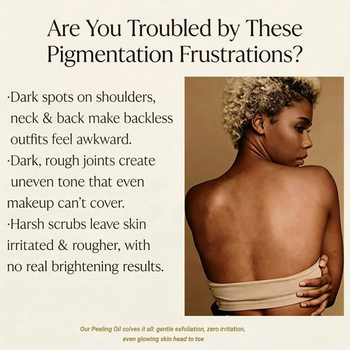 Aussie Betta Extra Strong Peeling Oil — Are You Troubled by These Pigmentation Frustrations? Dark spots on shoulders, rough joints, harsh scrubs that don't work