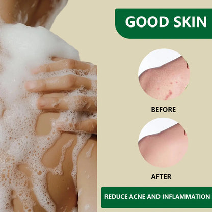 Aussie Betta Gold Turmeric & Lanolin Soap Aussie Betta