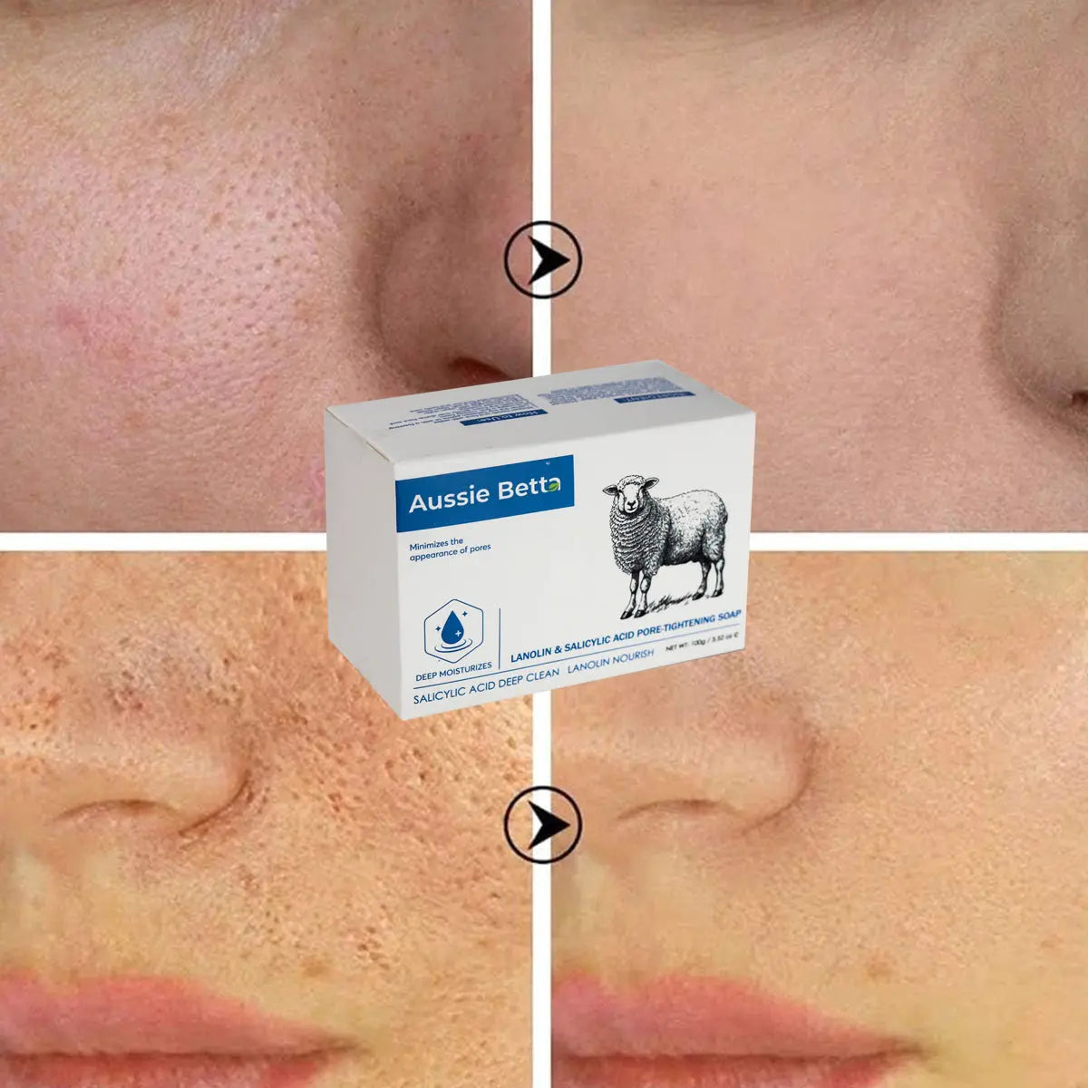 Aussie Betta Lanolin & Salicylic Acid Pore-Tightening Soap Aussie Betta