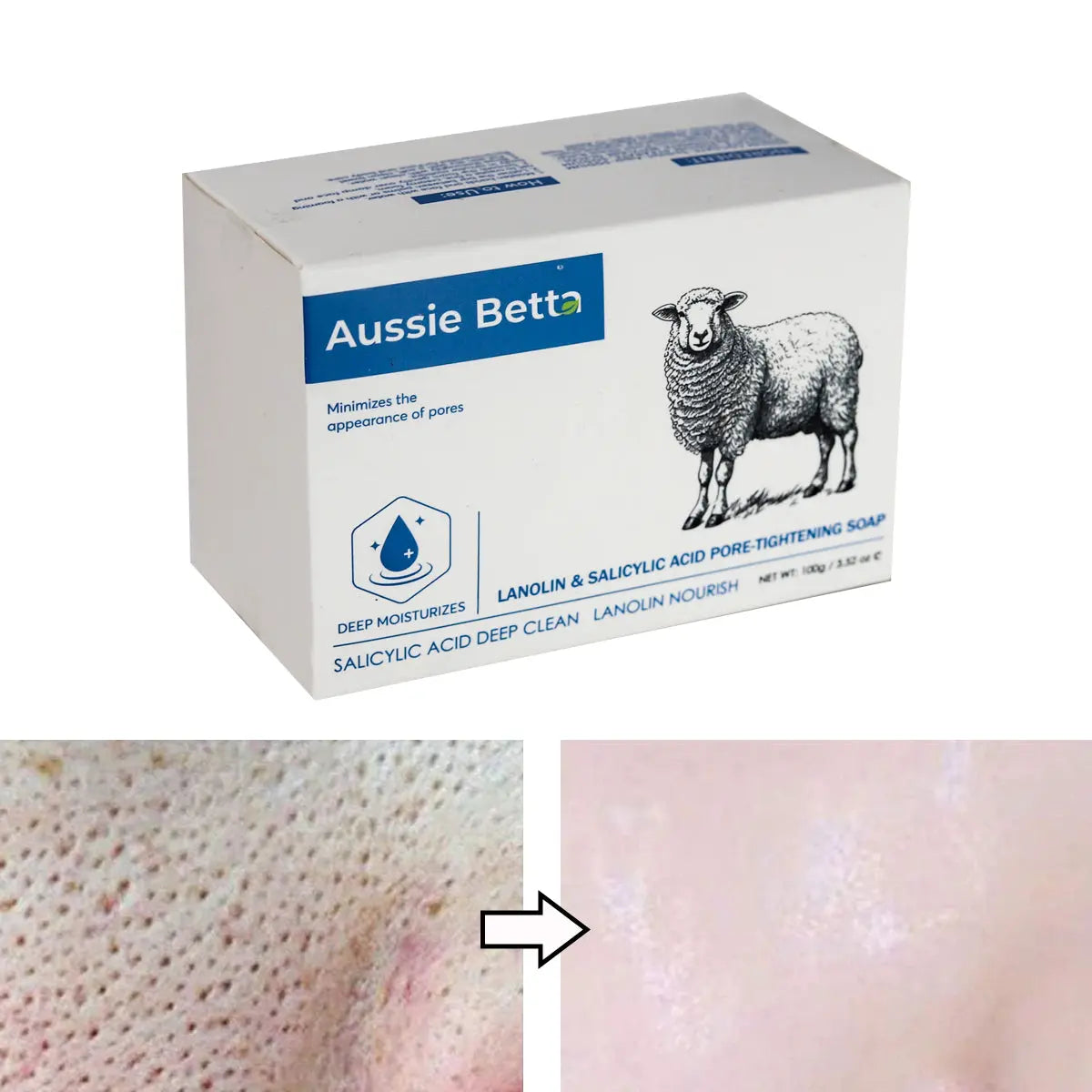 Aussie Betta Lanolin & Salicylic Acid Pore-Tightening Soap Aussie Betta