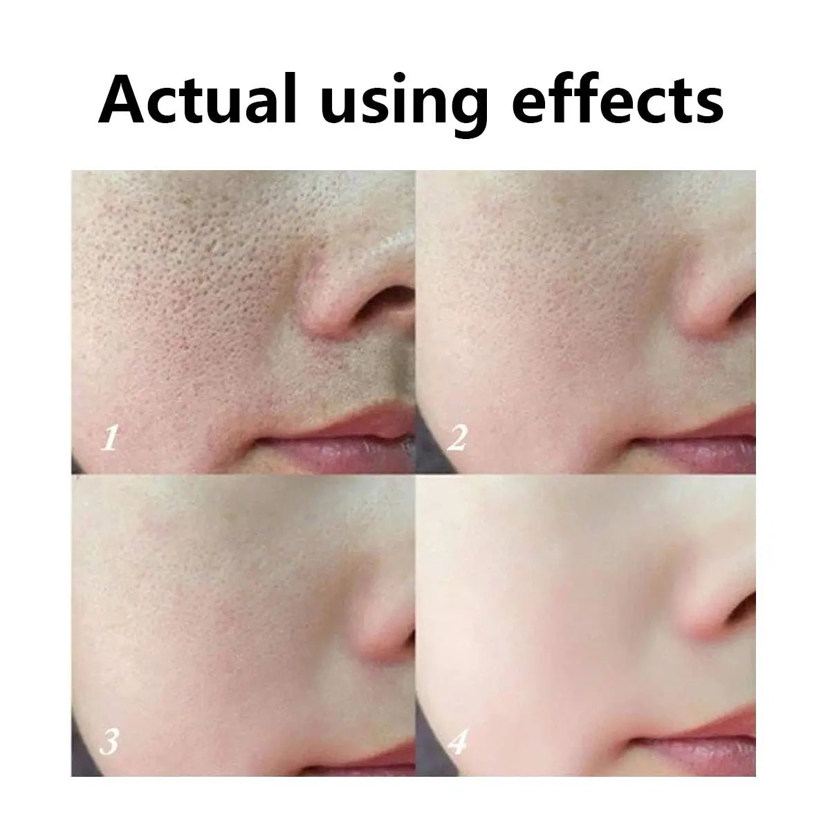 Aussie Betta Lanolin & Salicylic Acid Pore-Tightening Soap Aussie Betta