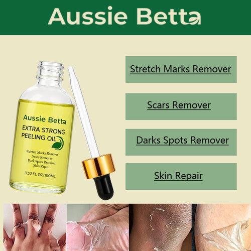 Aussie Betta Yellow Peeling Oil: Gentle Body Hyperpigmentation Treatment | Fade Dark Spots in 2 Weeks