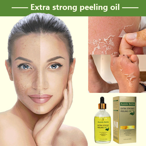 Aussie Betta Yellow Peeling Oil: Fade dark spots and blemishes, revealing a radiant, even complexion